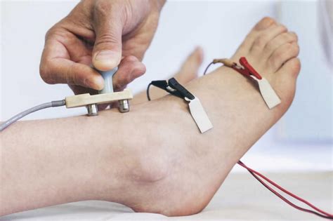 test for nerve compression|nerve conduction test painful.